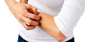 از زونا چه می دانید؟