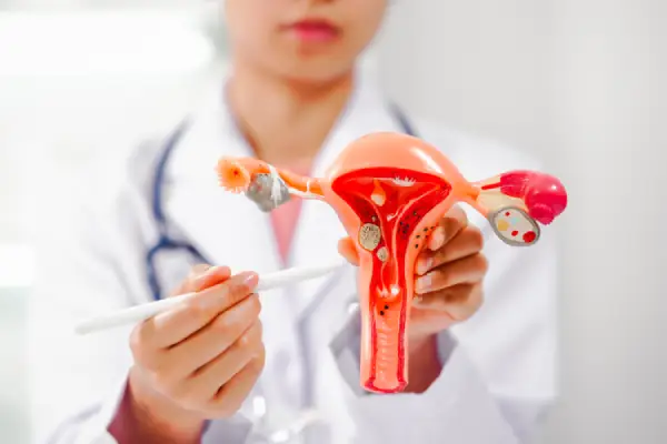 تنبلی تخمدان چیست